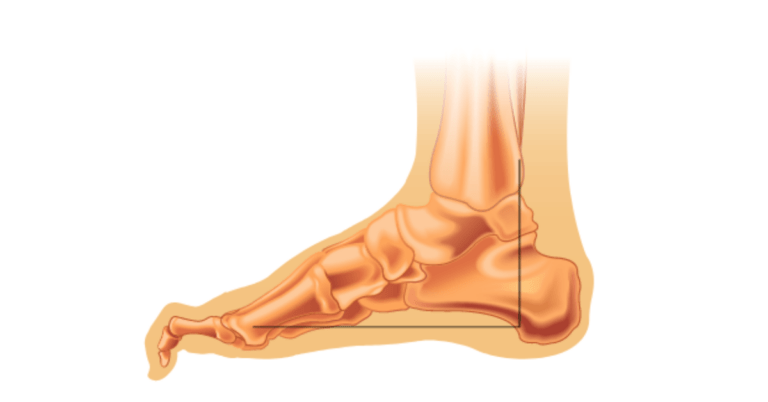 Hammertæer-1200x628-1